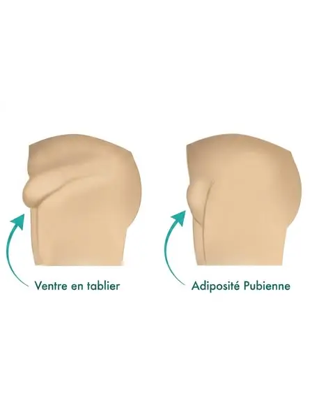 Ton Cortisol Est Élevé Parce Que Ton Foie Est Surchargé