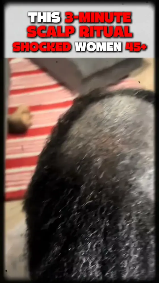 ✨ A 3-Minute Scalp Ritual