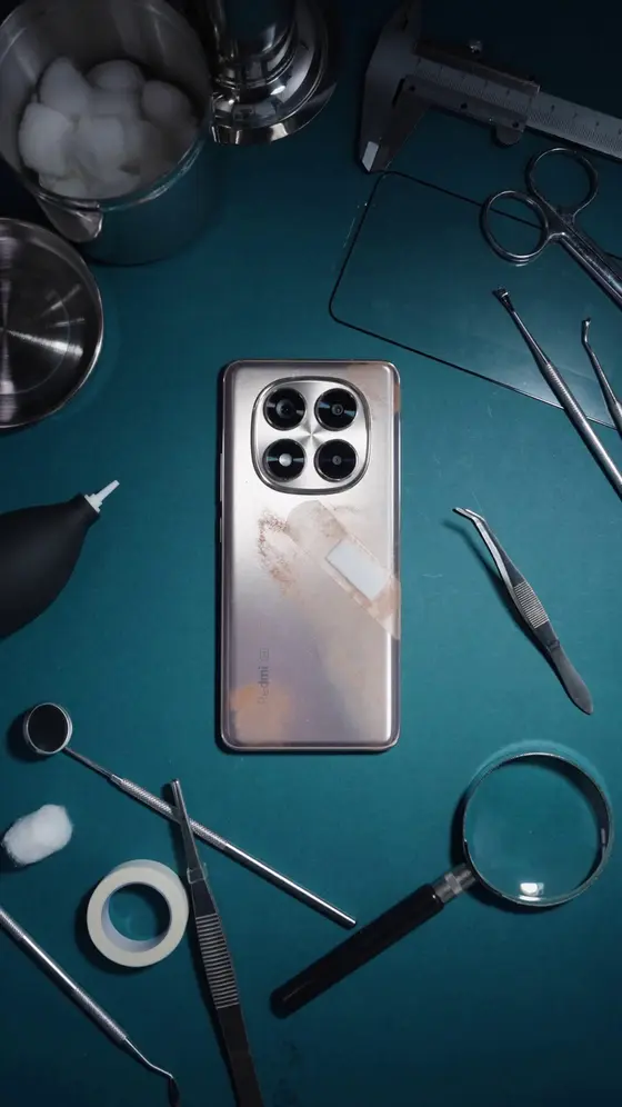 Doctor says it’s healing perfectly. #RedmiNote14Pro5G